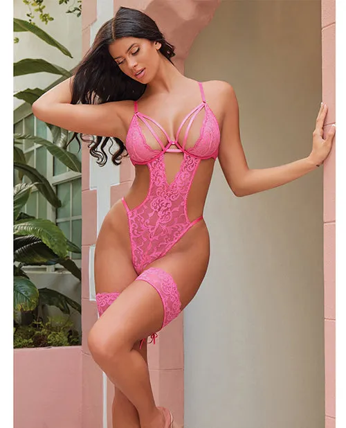 Genesis Lace Underwire Teddy with Lace Garter Stays